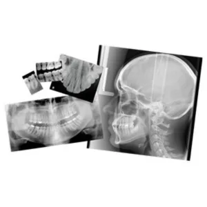 Velopex Extra-X Automatic Dental X-Ray Film Processor