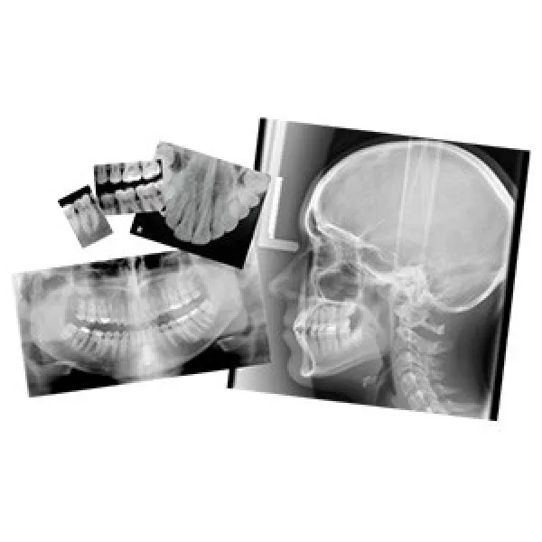Velopex Extra-X Automatic Dental X-Ray Film Processor