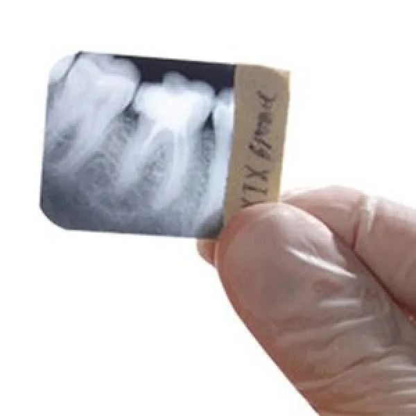 Velopex Intra X – Automatic Dental X-Ray Film Processor
