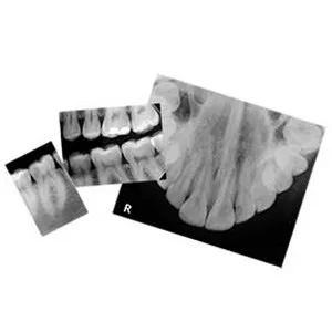 Velopex Intra X – Automatic Dental X-Ray Film Processor